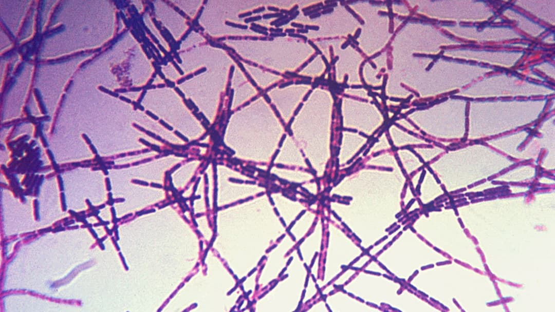 4. Reanimated Anthrax Spores