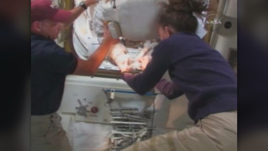 18. Spacesuit Glove Fingernail Loss