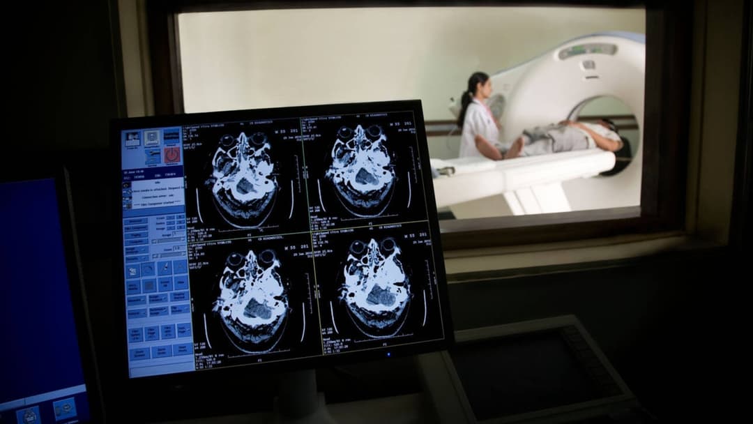 High-resolution cross-sectional neuroimaging brain scans displayed on a clinical monitor