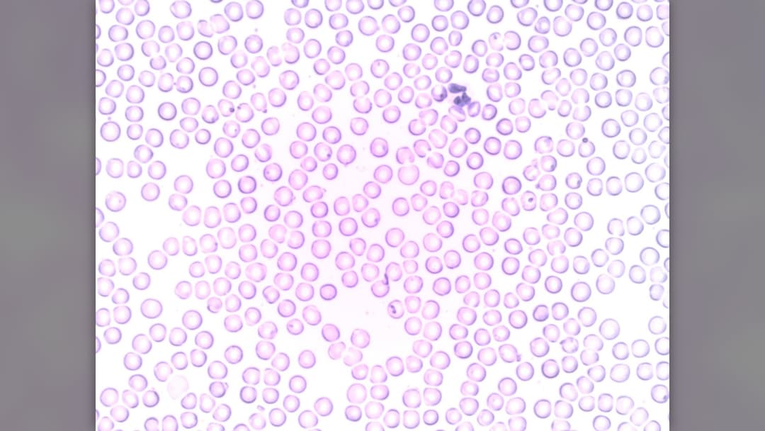 Landscape microscope image of a segmented neutrophil white blood cell surrounded by red blood cells