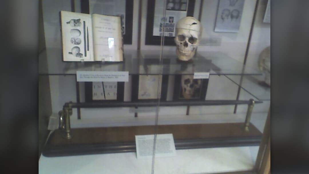 #11. Phineas Gage's Brain-Rod Survival (USA, 1848)