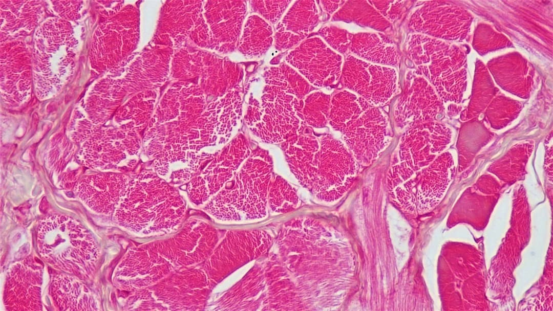 6. Muscular Dystrophin Integrity