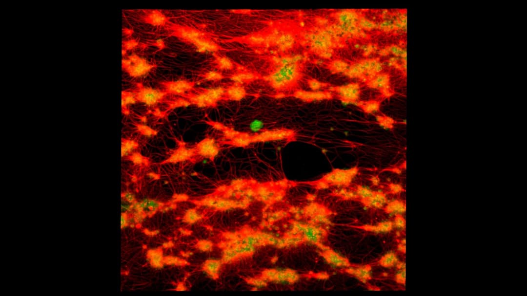 5. Blood Clotting Factors