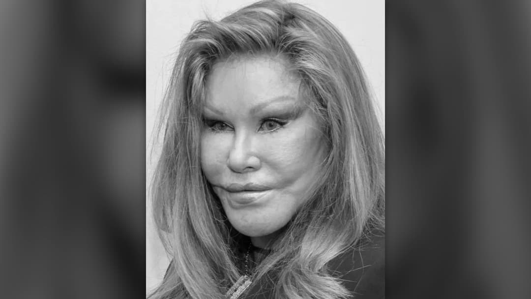 Jocelyn Wildenstein portrait