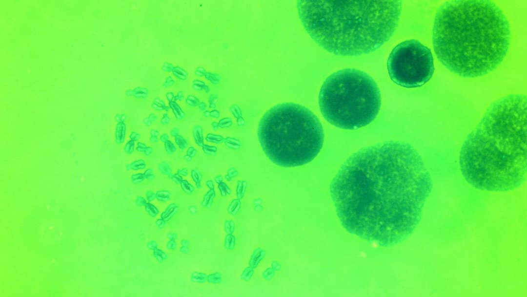 10. Angelman Gene Expression