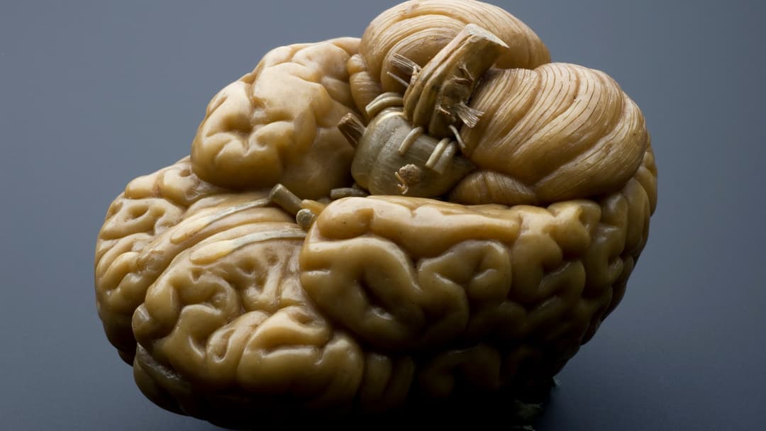 #3. It Activates The Brain's Reward Circuitry
