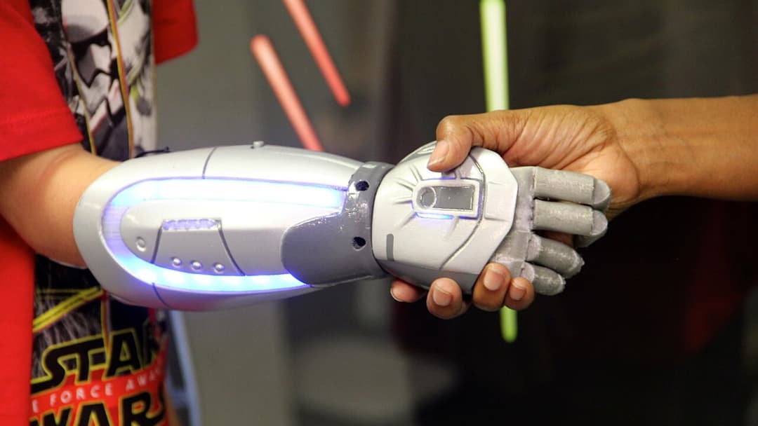 18. Neural Prosthetic Bionic Limbs