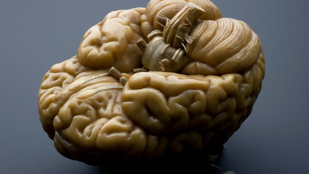 An anatomical model displaying the left and right cerebral hemispheres of the human brain.