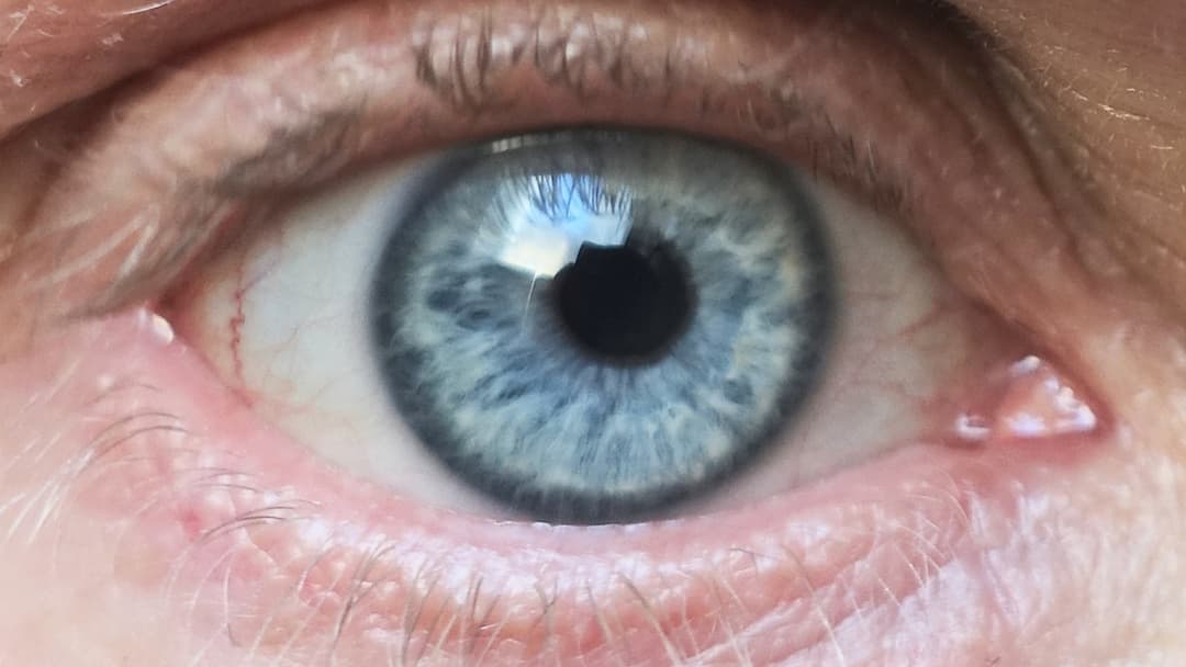 6. Blue Eyes And Increased Light Sensitivity
