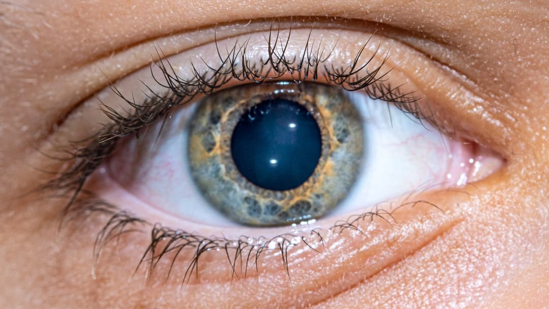 13. Hazel Eyes And Polygenic Inheritance
