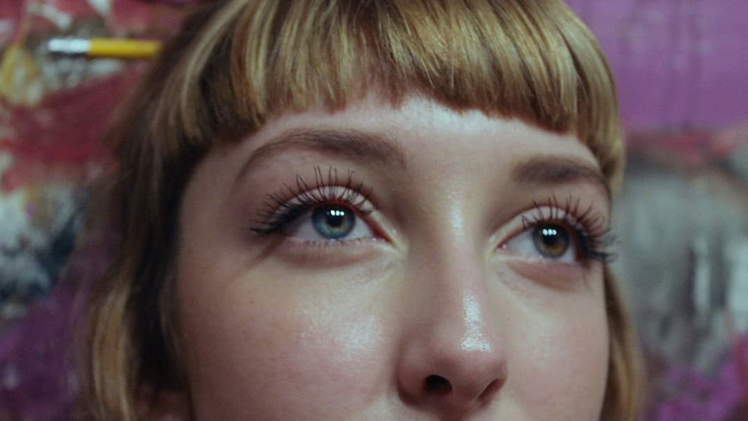 17. Complete Heterochromia And Genetic Mosaicism