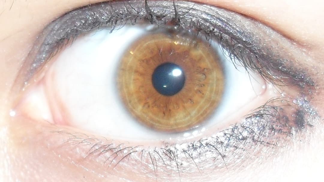 15. Amber Eyes And The Rare Lipochrome Pigment