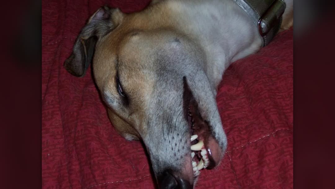 #1 Periodontal And Dental Disease
