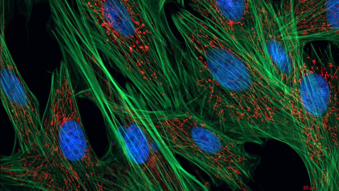 High-resolution fluorescent microscopy showing active cellular organelles and mitochondria.