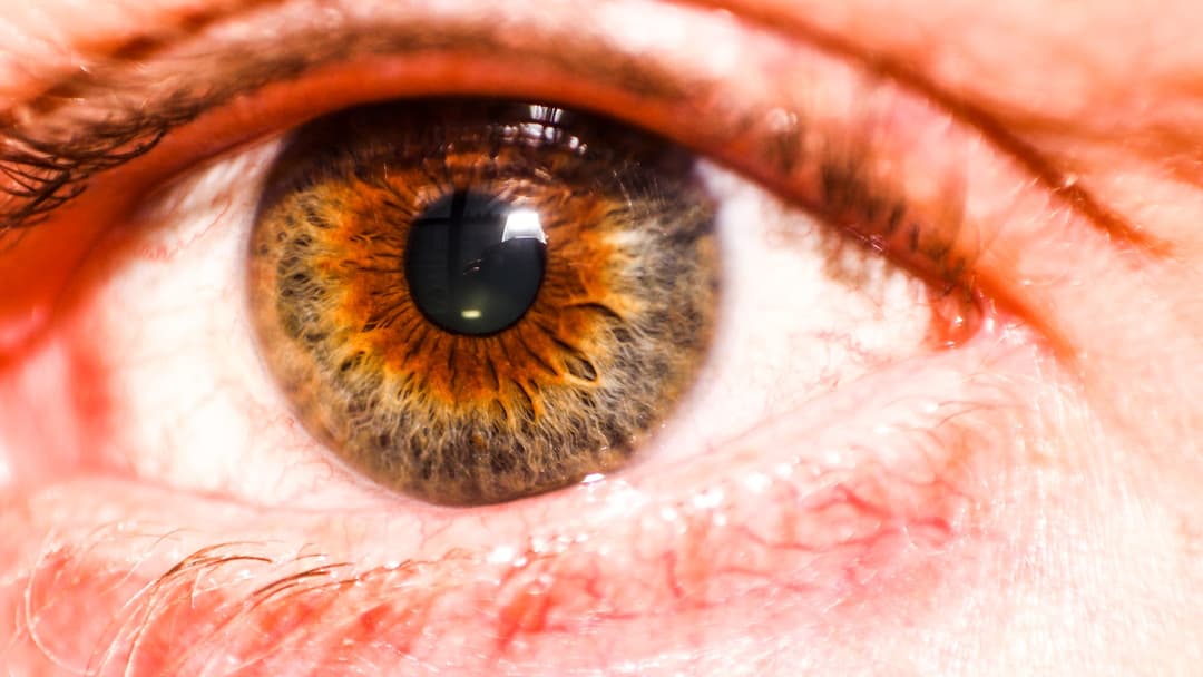 14. Hazel Eyes And The Central Melanin Ring