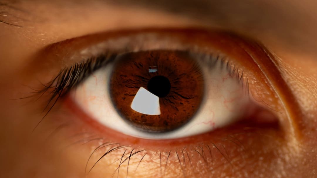 2. Brown Eyes And Lower Risk Of Melanoma