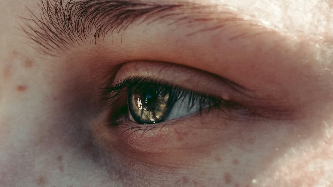 11. Green Eyes And Moderate Photoprotection