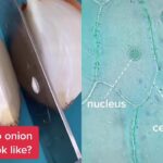 What Onion Cells Look Like Under the Microscopic View || WooGlobe