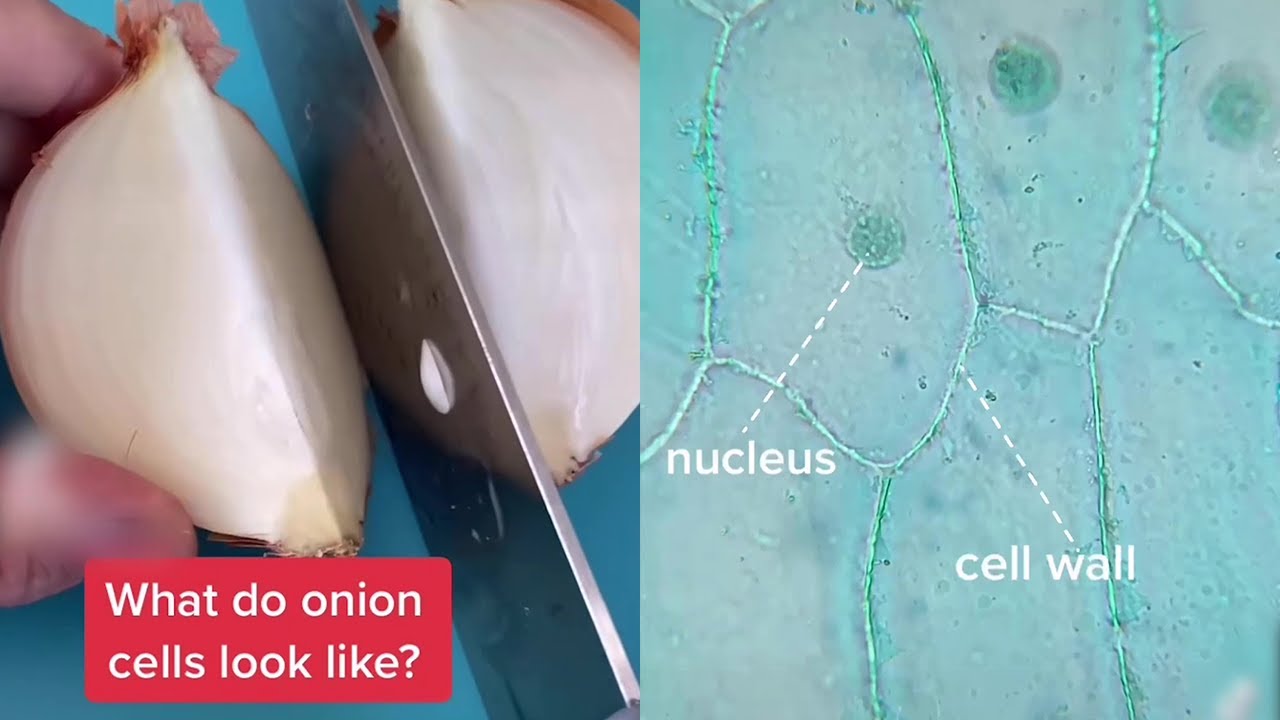 What Onion Cells Look Like Under the Microscopic View || WooGlobe